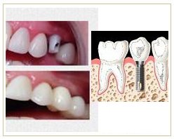 Slider image (6) Dentist Alanya